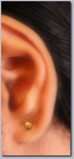 Pierced ear